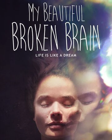 Khối óc xinh đẹp tội nghiệp của tôi | My Beautiful Broken Brain (2016)